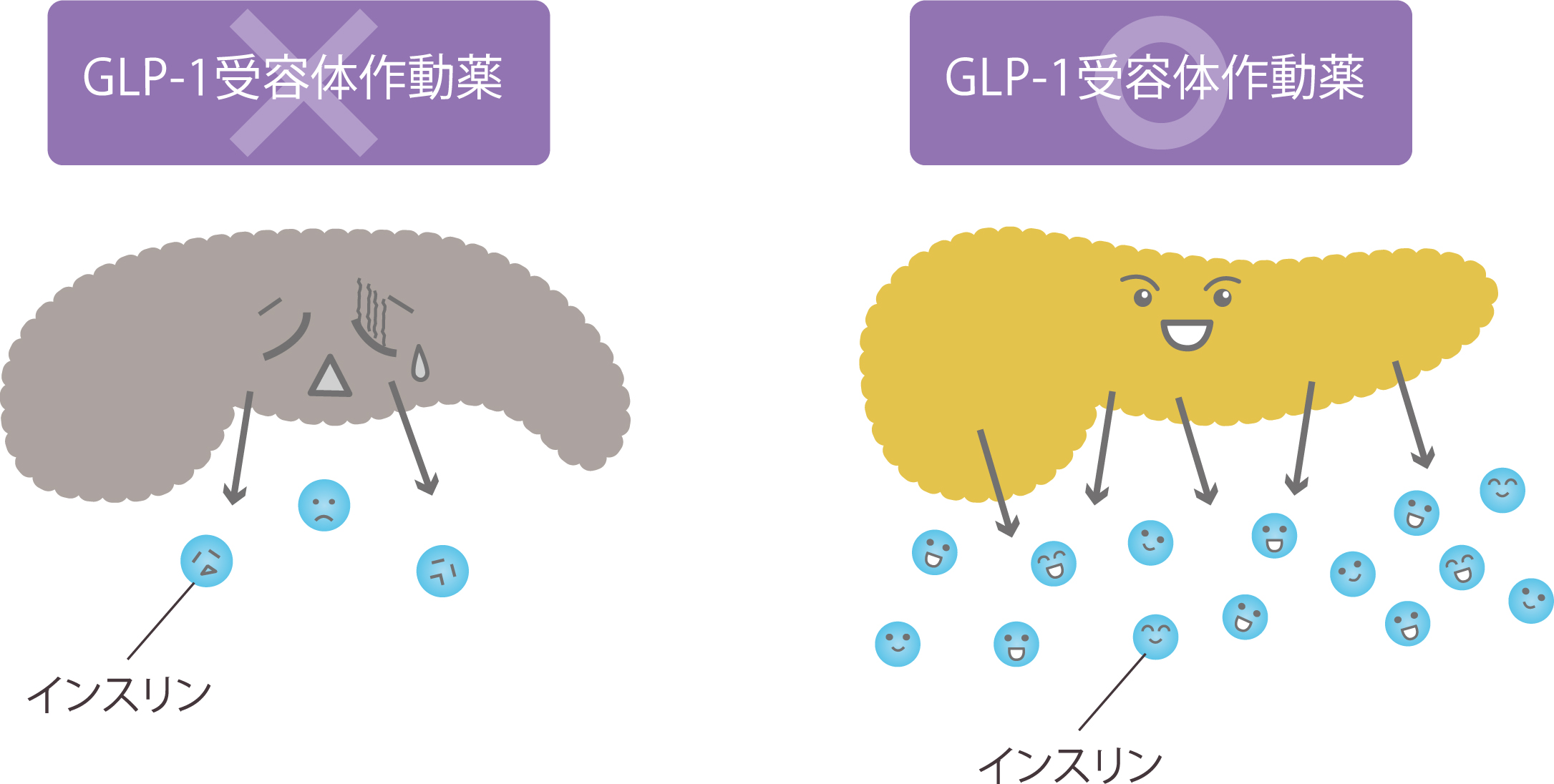 GLP-1受容体作動薬が適している患者さん